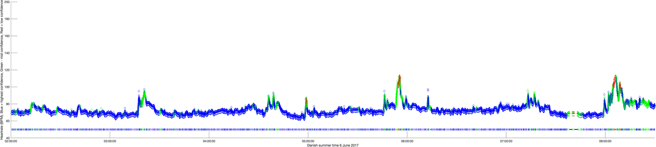 A graph showing heart rate over time

Description automatically generated with medium confidence